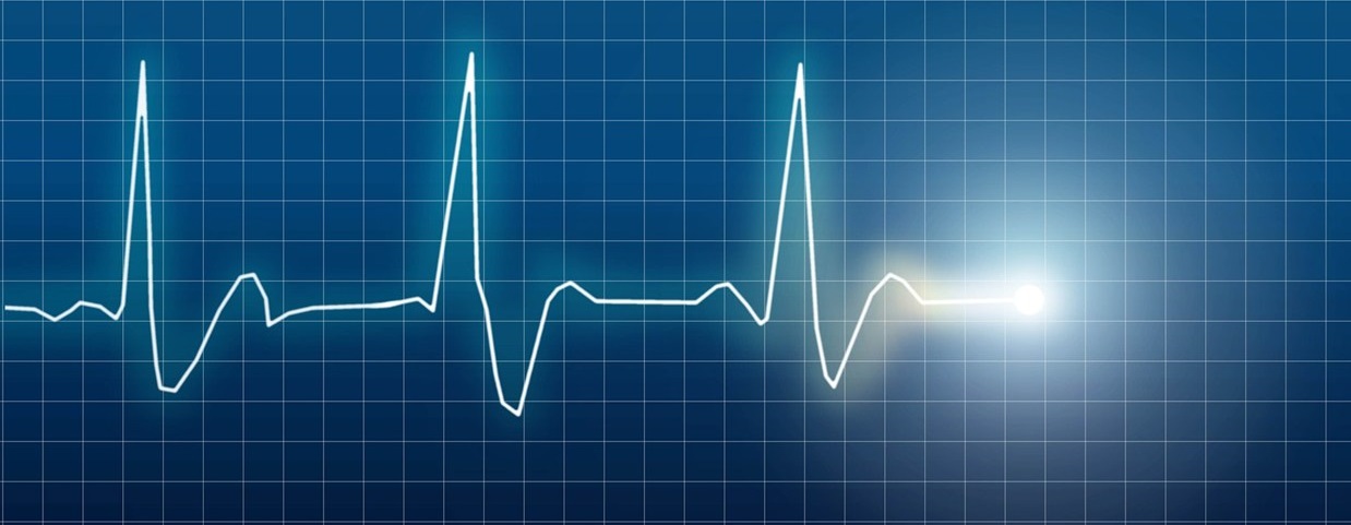 missed-heartbeats - Copy